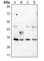 PPP1R1B (Phospho-T34) antibody