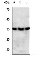 PPT1 antibody