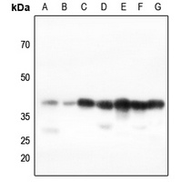 Anti-AMPK beta 1 Antibody