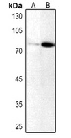 PRKCI (Phospho-T412/410) antibody