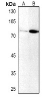 Anti-PKC iota/zeta (Phospho-T412/410) Antibody