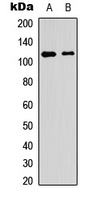 PTPRA (Phospho-Y798) antibody