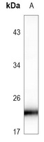 RAB8B antibody