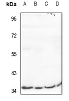 RIMKLB antibody