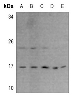 Anti-RPS23 Antibody