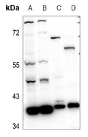 RRM2B antibody
