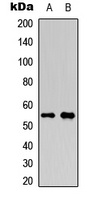 RUNX1 (Phospho-S276) antibody