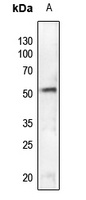 Anti-SGK1 (Phospho-S78) Antibody