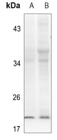 alpha Synuclein (Phospho-Y133) antibody