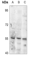 Anti-Tyrosine Hydroxylase (Phospho-S19) Antibody