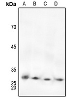 TNNI3 (Phospho-S22/S23) antibody
