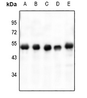 Anti-VASP (Phospho-S238) Antibody