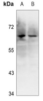Anti-Ku70 (Phospho-S5) Antibody