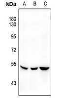 SGK1 (Phospho-S422) antibody