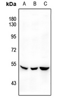 Anti-SGK1 (Phospho-S422) Antibody