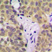 SGK1 (Phospho-S422) Rabbit Polyclonal Antibody