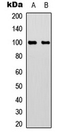 ACO1 (Phospho-S711) antibody