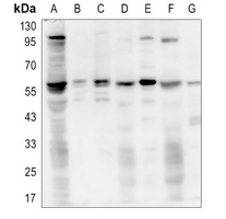 AKT1 (Phospho-T450) antibody