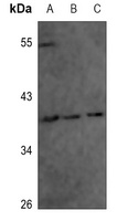 Anti-Annexin A1 (Phospho-Y21) Antibody