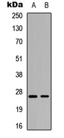 Anti-RhoGDI alpha (Phospho-S174) Antibody