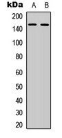 Anti-ATP7B Antibody