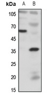 Anti-BDKRB1 Antibody