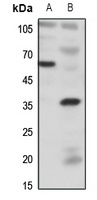 BDKRB1 antibody