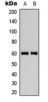 CAMK4 (Phospho-T200) antibody