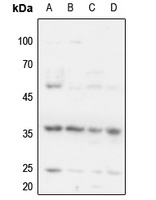 Anti-Cyclin H (Phospho-T315) Antibody