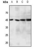 CCRL1 antibody