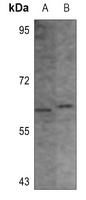 CHEK1 (Phospho-S296) antibody