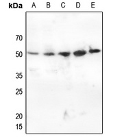 CHEK1 (Phospho-S345) antibody