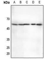 CHEK2 (Phospho-T68) antibody