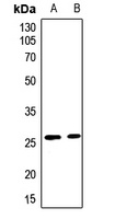 CLIC3 antibody