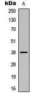 CSNK1A1 (Phospho-Y294) antibody