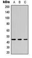 Anti-CK2 alpha Antibody