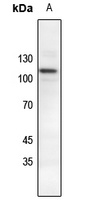 CTNND1 (Phospho-Y228) antibody