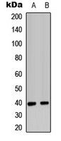 Anti-CD182 Antibody
