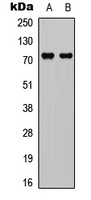 Anti-DDX3X Antibody