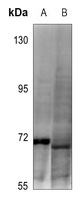 DDX5 (Phospho-Y593) antibody