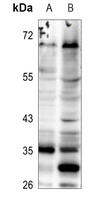 Anti-ELOVL5 Antibody
