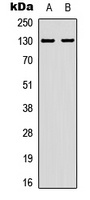 EPHA2 (Phospho-Y588/596) antibody