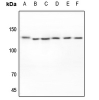 Anti-EPHA2 Antibody