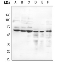 Estrogen Receptor beta (Phospho-S105) antibody