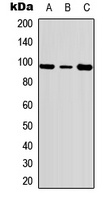 Anti-c-FER (Phospho-Y402) Antibody