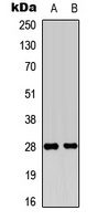 Anti-FGF19 Antibody