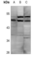 Anti-GDF9 Antibody