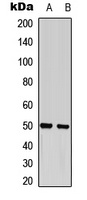 GFAP (Phospho-S38) antibody