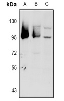 GPR101 antibody