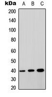 Anti-GPRC5A Antibody